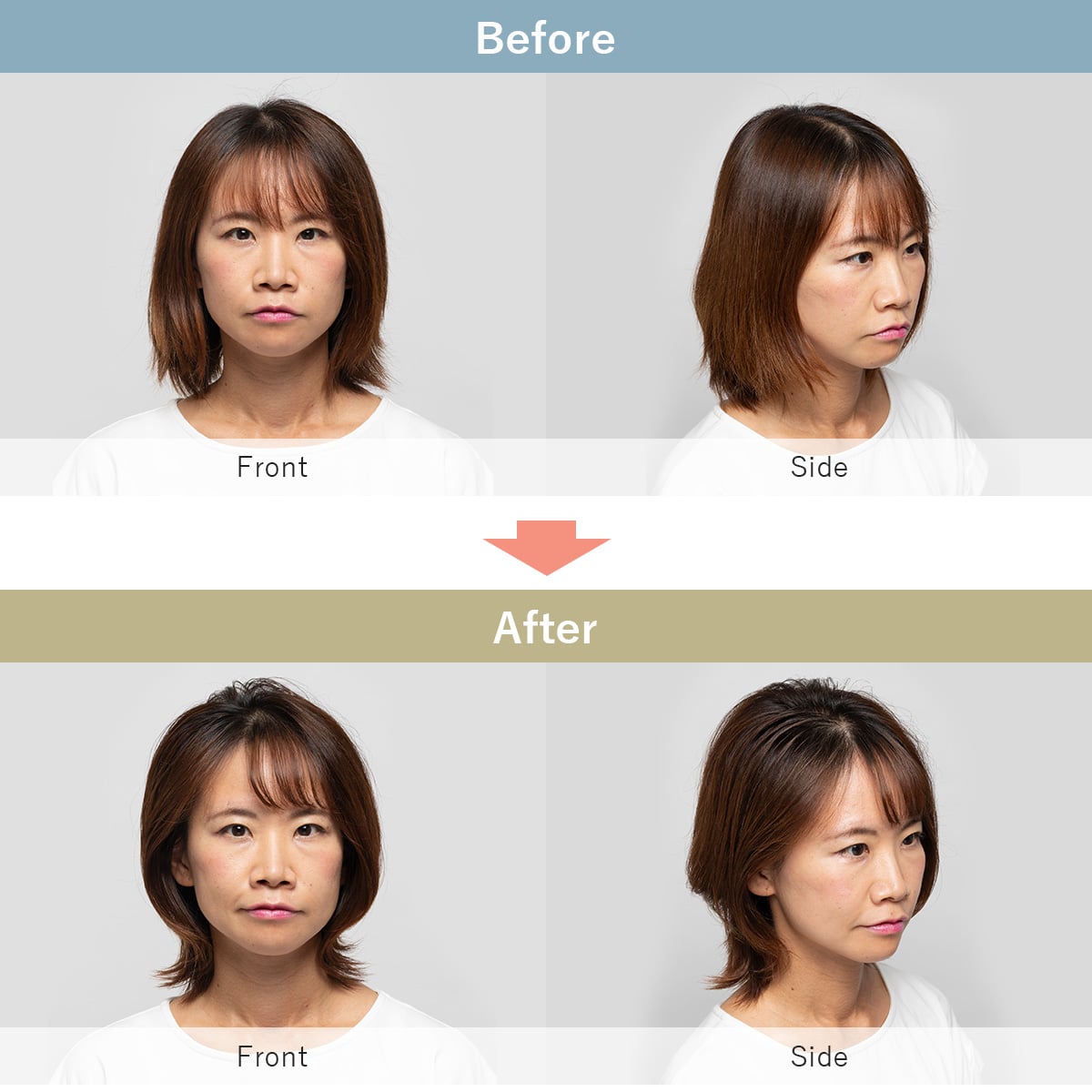 ヘアボリューマープロ | ABCミッケ｜【公式】ABC通販サイト