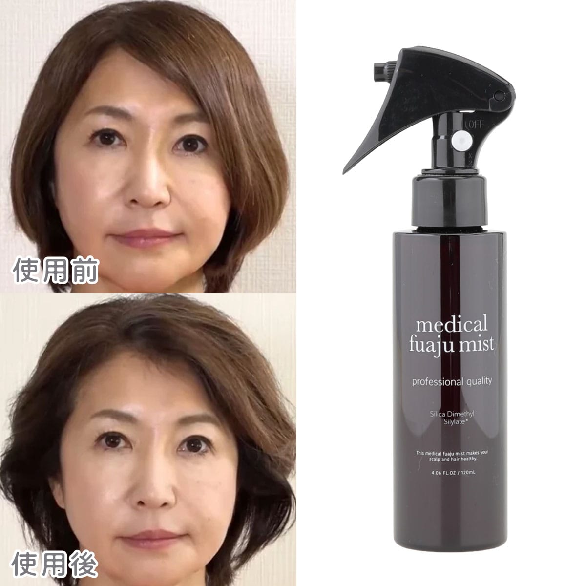 3/2～3/8】メディカルフワージュミスト 3本 | ABCミッケ｜【公式